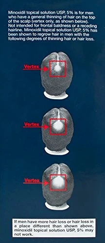 УЗИ система G76