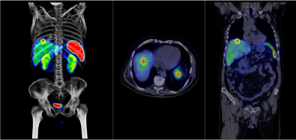 AnyScan Trio SPECT/CT/PET tizimi