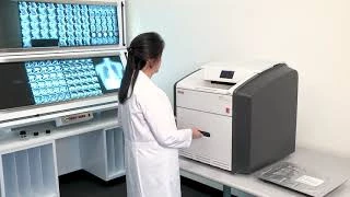 Carestream (SSHA) Vita CR Digitayzer (osifrovshik rentgenovskix izobrajeniy)