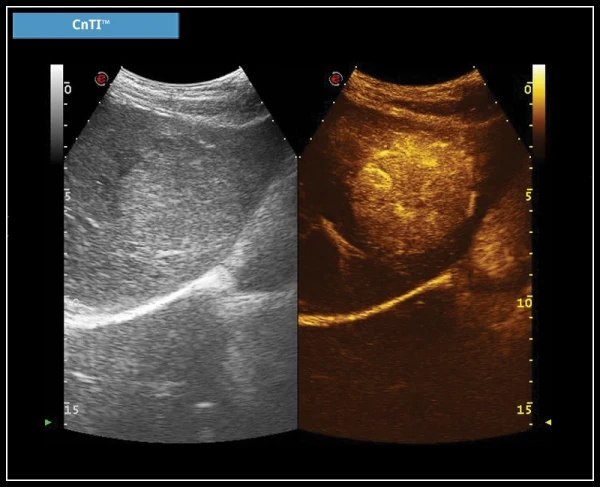 ESAOTE MYLAB X7 ekspert toifali ultratovush apparati