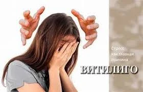 Комплекс специальных восстанавливающих средств для витилиго