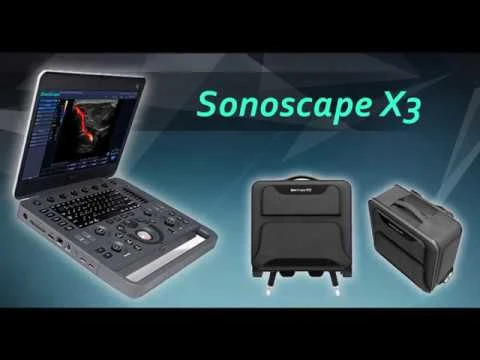 УЗИ аппараты Sonoscape