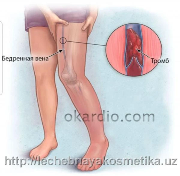 Doktor Ven krem tuba 75 ml