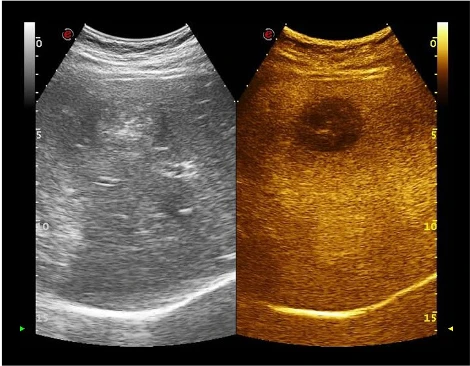 УЗИ аппарат Esaote MyLab X6