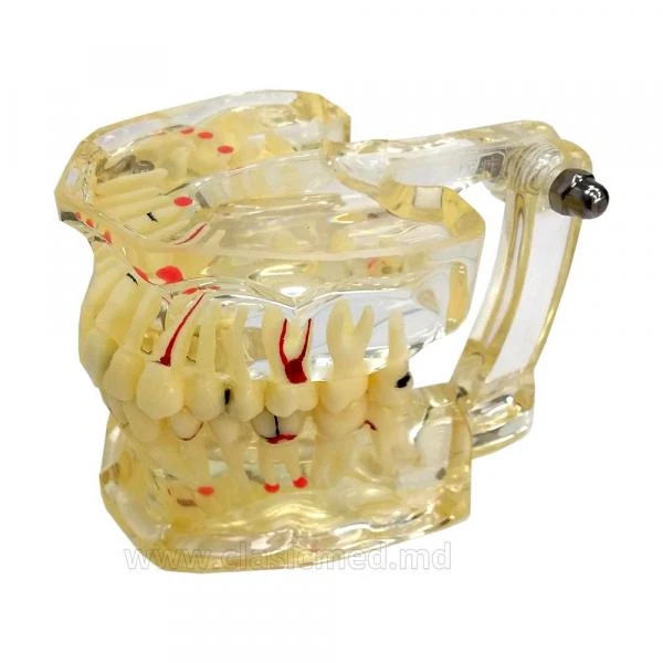 Муляж Adult pathology model