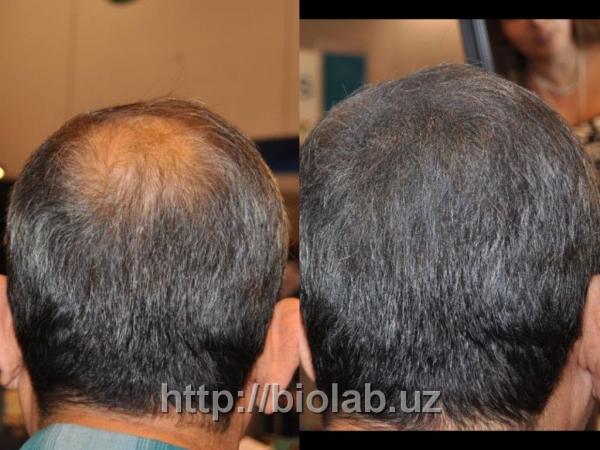 Загуститель волос toppik маскировка залысин