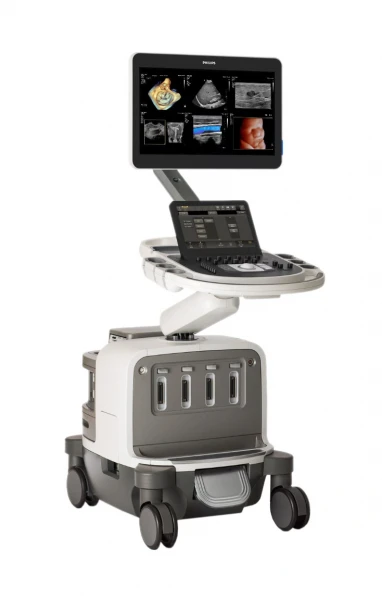 Ultrazvukovaya sistema Philips EPIQ Elite