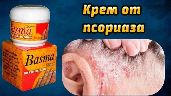 Лечебный крем от псориаза "Basma"