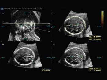 Система ультразвуковой диагностики  Модель: SonoScape S-40