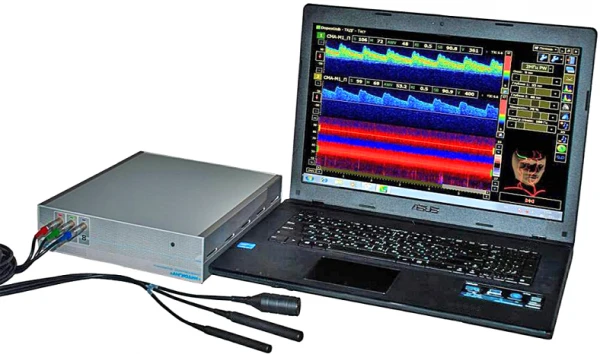 Exoensefaloskop (Exoensefalograf)