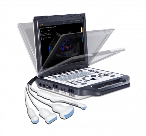 Perenosnoy Ultrazvukovoy skaner EMP G30 ot kompanii Emperor Medical