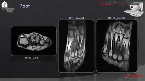 Magnifico yangi avlod MRI tizimi