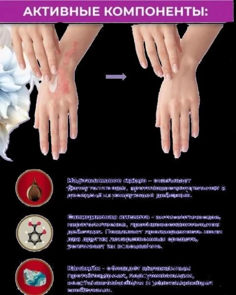 Psoriaz uchun krem ​​PsoriSpas