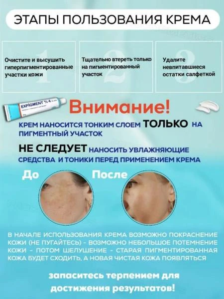 Осветляющий крем при нарушении пигментации кожи Expigment 4% (30 грамм)
