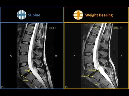 Поворотная система МРТ G-Scan