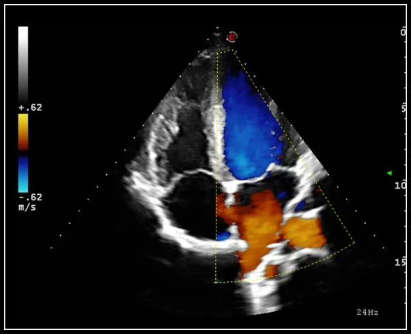 Ko'p funktsiyali ultratovushli tomograf Esaote MyLab 9 eXp