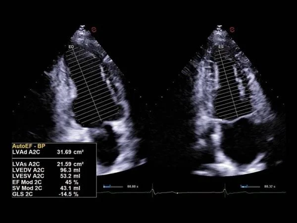 GE17-0230-01 SP-Сефадекс C-25,100 гтSP-SEPHADEX C-25, 100 G,