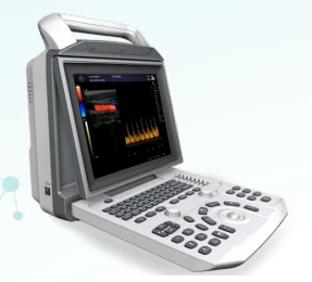 Zoncare-m5 ultratovush diagnostika tizimi