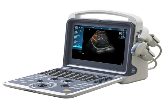 Ultrazvukovaya sistema K0