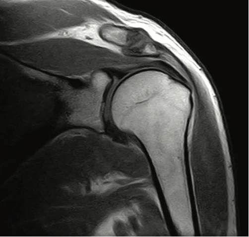 МРТ для исследования костно-мышечной системы Esaote S-Scan