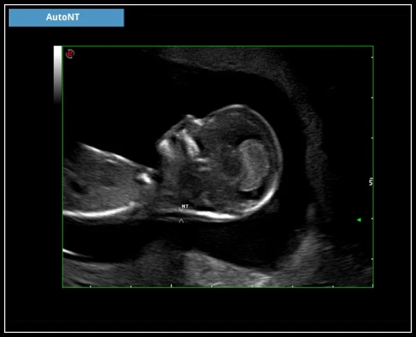 ESAOTE MYLAB X7 ekspert toifali ultratovush apparati
