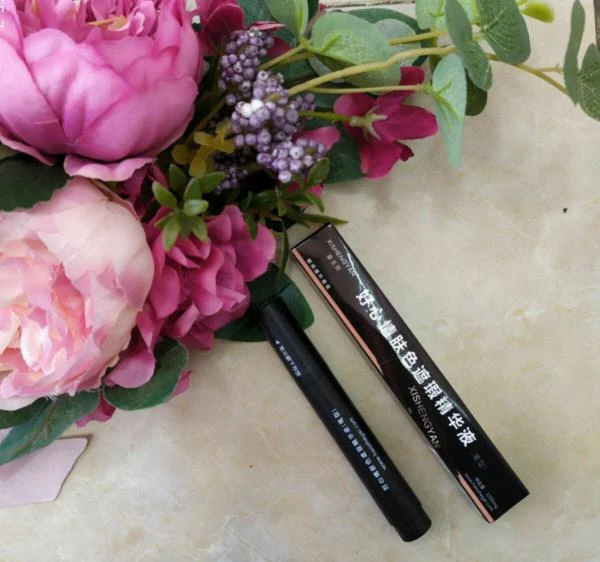 Vitiligo dan poydevor belgisi