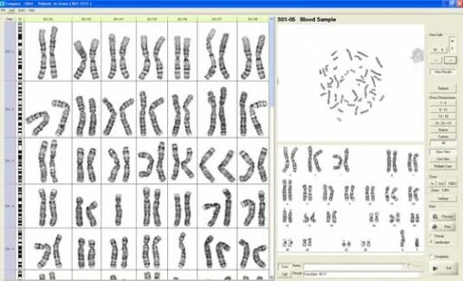 Программный модуль для диагностики кариотипов GenASIs BandView