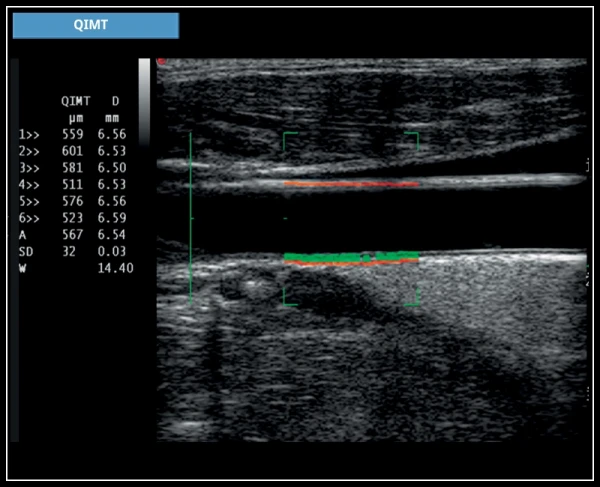ESAOTE MYLAB X7 ekspert toifali ultratovush apparati