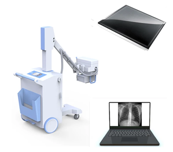 Sifrovoy rentgenovskiy PLX5100