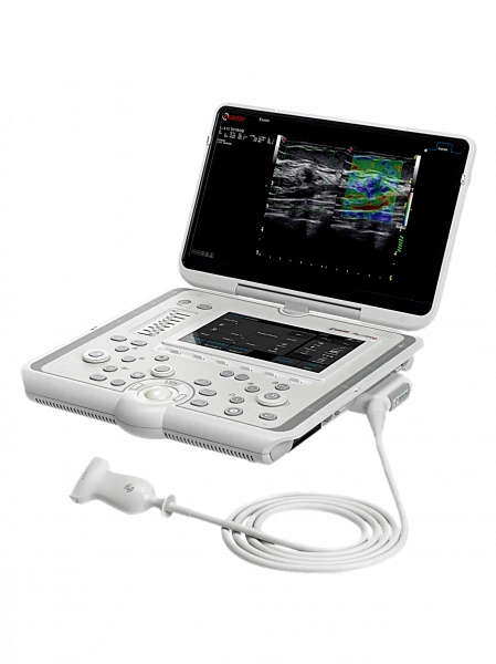 Portativ ultratovush apparati Esaote MyLab OMEGA