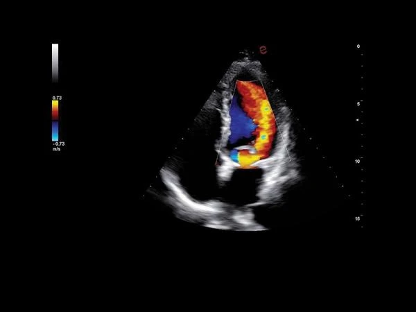GE17-0230-01 SP-Сефадекс C-25,100 гтSP-SEPHADEX C-25, 100 G,