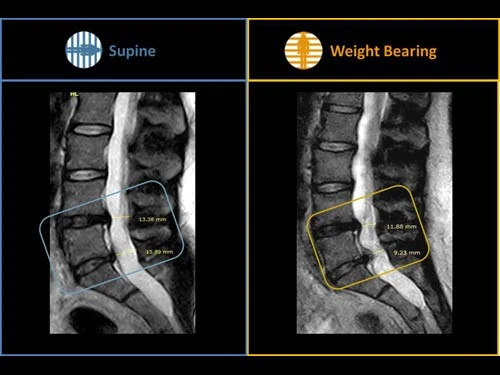 МРТ для углубленных исследований мышечно-скелетной системы G-Scan Esaote