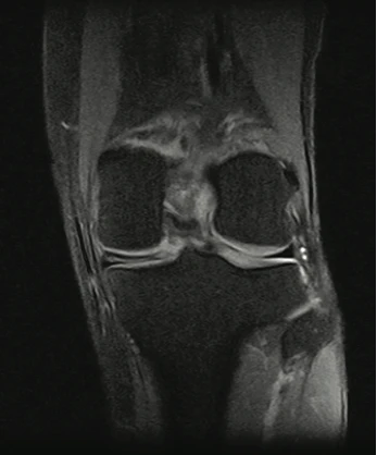 МРТ для исследования костно-мышечной системы Esaote S-Scan