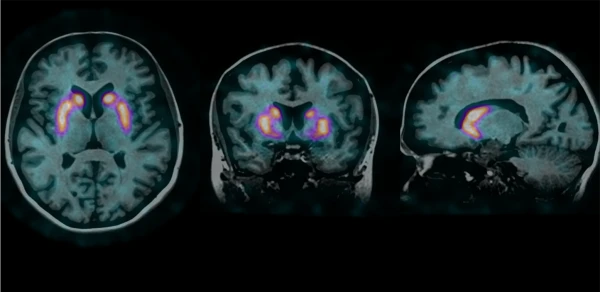 AnyScan Trio SPECT/CT/PET tizimi