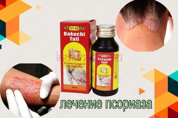 Vitiligo va psoriaz uchun Bakuchi yog'i