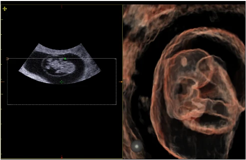 УЗИ аппарат Esaote MyLab X6