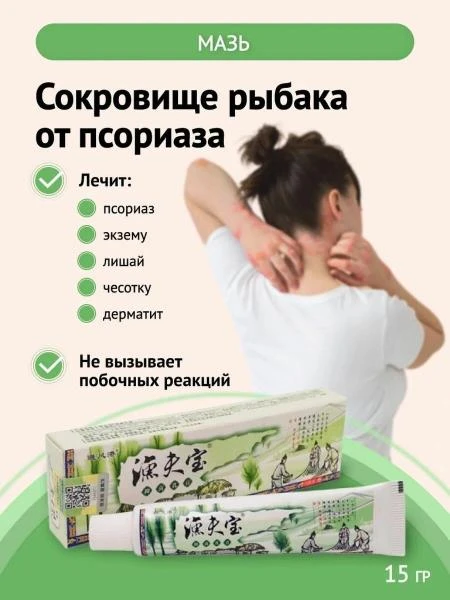 Psoriaz, dermatit, liken, qichishish uchun "baliqchining xazinasi" malhami