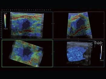 Sistema ultrazvukovoy diagnostiki  model: SonoScape-S50