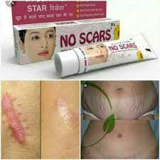 Krem dlya udaleniya shramov No Scars