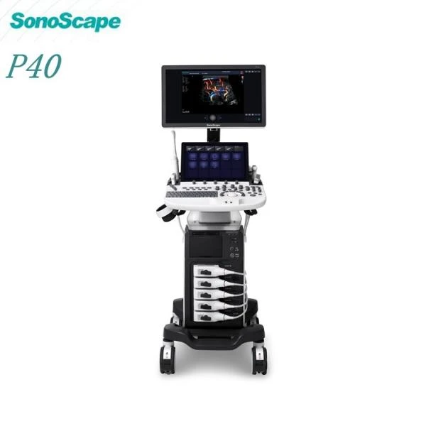 Sistema ultrazukovaya diagnostika  Model: SonoScape P-40