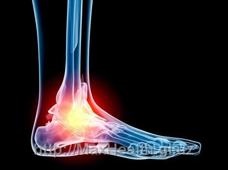 Gel dlya dusha ot Iv Roshe Zelyoniy limon Meksiki