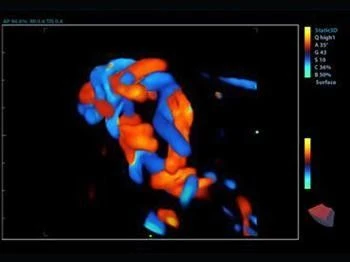 Система ультразвуковой диагностики  Модель: SonoScape S-40