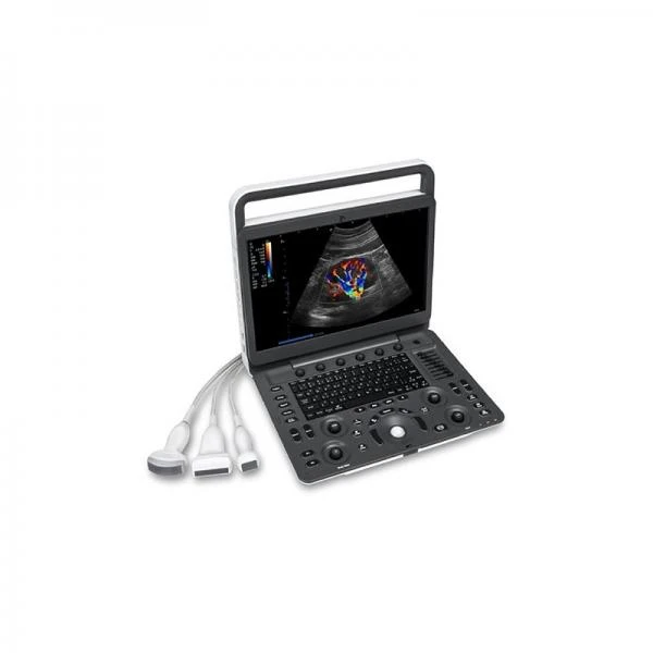 УЗИ SonoScape стационарные и портативные с Доплером