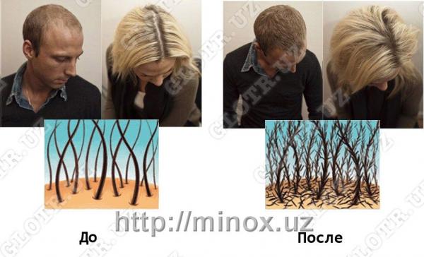 Sochlar qalinligini oshirish vositasi MinoX Hair Magic