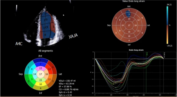 Esaote MyLab Omega ekspert sinfining portativ ultratovush tizimi