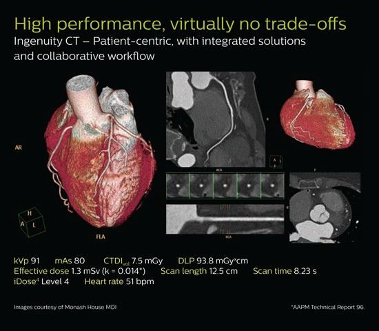 Компьютерный томограф Philips Ingenuity 64/128