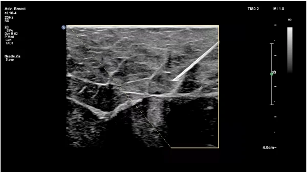 Ультразвуковая система Philips EPIQ Elite