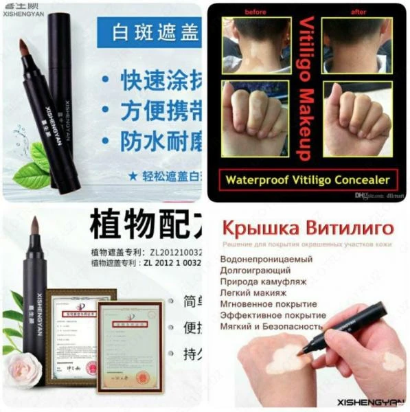 Zanderm spot vitiligo uchun aplikatori