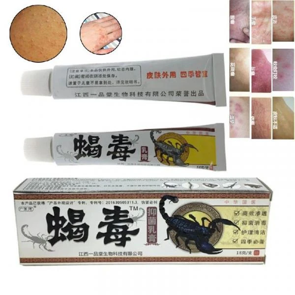 Chayon zaharidagi malham oyoq qo'ziqorini va toshbaka kasalligi uchun