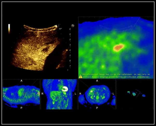 Ультразвуковой томограф нового поколения Esaote MyLab 9 eXp